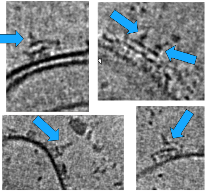 C1 bound to Ab on vesicles